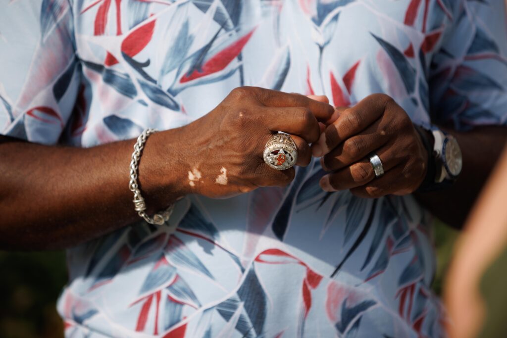 Danan Hughes hands with Chiefs rings.